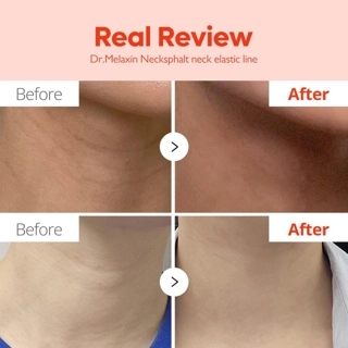 DOCTOR MILAXIN CREAM FACE LIFT AND WRINKLE RESISTANT